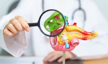 Pedra na vesícula: conheça os sintomas da doença