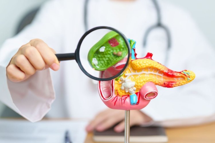 Pedra na vesícula: conheça os sintomas da doença